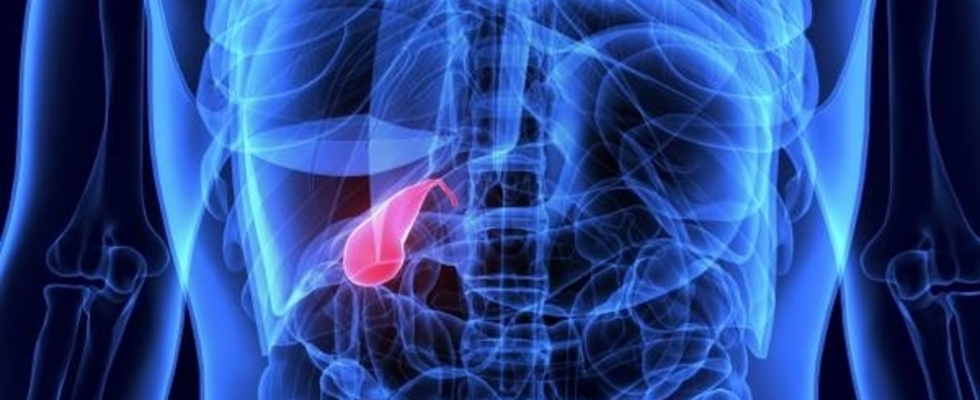 Cirurgia da Vesícula Biliar